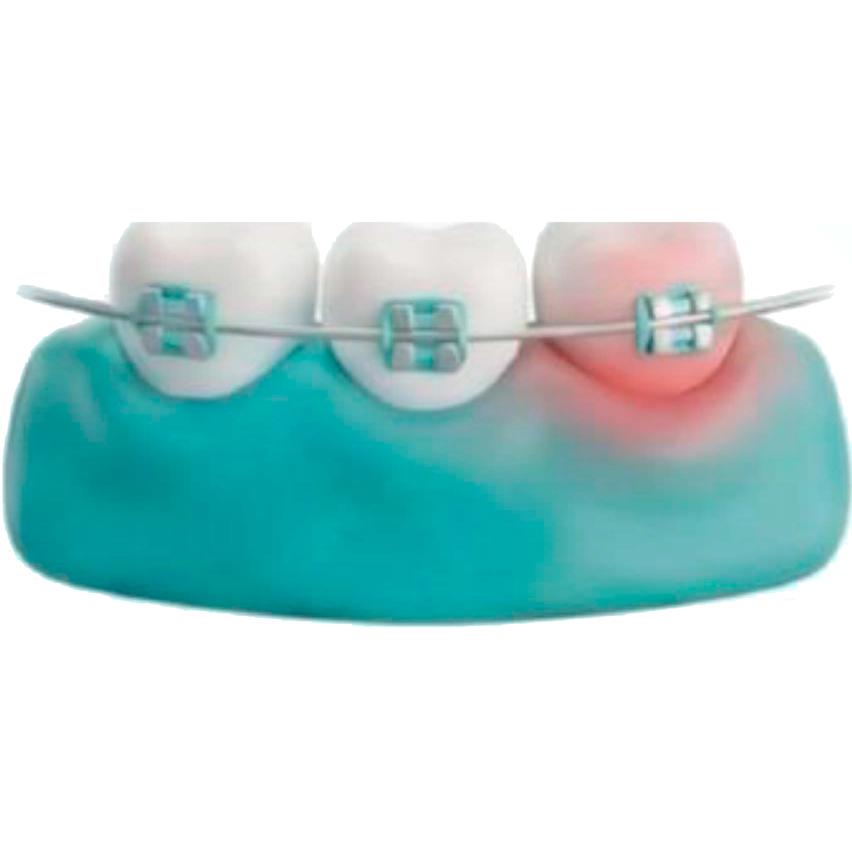 Снижает кровоточивость